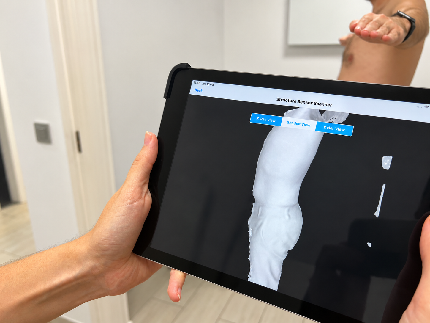Tablet mostrando el modelo digital del torso obtenido mediante escaneo 3D para la toma de medidas ortopédicas.